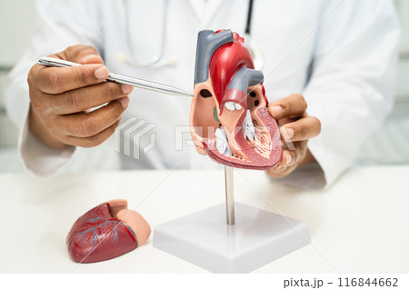 Cardiovascular disease CVD, Asian doctor holding human anatomy model for learn and treat heart disease. 116844662