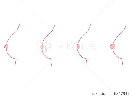 乳頭のかたち　乳首のタイプ　種類 116847941