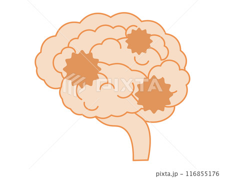 認知症になって機能が低下している脳のイメージのイラスト 認知症になって機能が低下している脳のイメージのイラスト 116855176