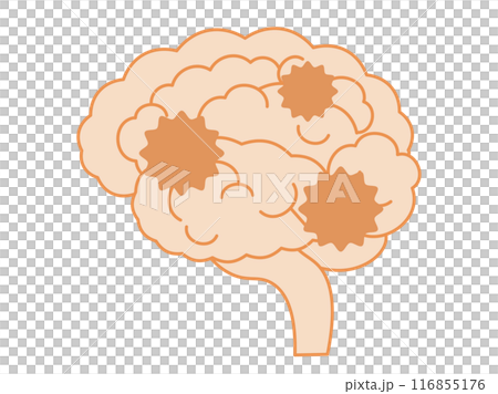 認知症になって機能が低下している脳のイメージのイラスト 認知症になって機能が低下している脳のイメージのイラスト 116855176