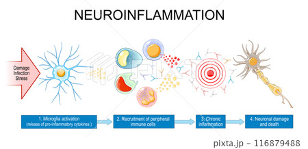 Neuroinflammation Neuroinflammation 116879488