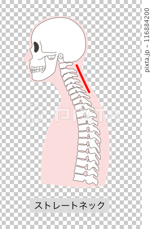 直頸人體骨骼插圖 116884200