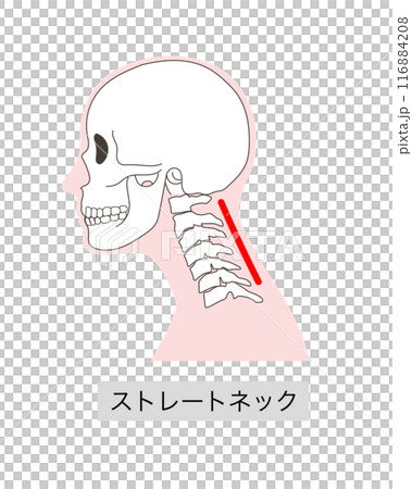 Illustration of the cervical vertebrae and skull of a straight neck 116884208
