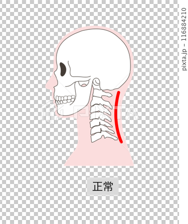 正常な頸椎と頭蓋骨の説明イラスト 116884210