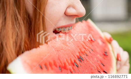 Close-up portrait of red-haired young woman with braces eating watermelon outdoors 116892771