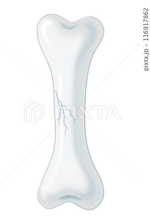 ひびの入った骨 116917862