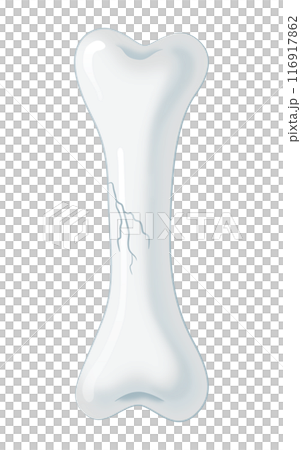 ひびの入った骨 116917862