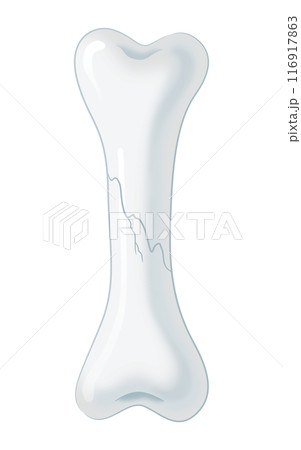 ひびの入った骨 116917863