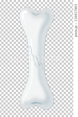 ひびの入った骨 116917863