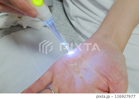 耳掃除 ear cleaning 耳掃除 ear cleaning 116927677