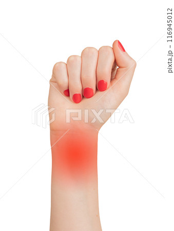 Pain in the hand with carpal tunnel syndrome. Symptoms include numbness, ache, and joint Pain in the hand with carpal tunnel syndrome. Symptoms include numbness, ache, and joint 116945012