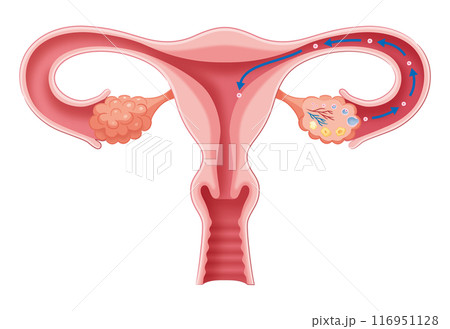 排卵から着床 116951128