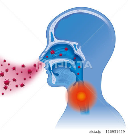 ウイルスの空気感染 116951429