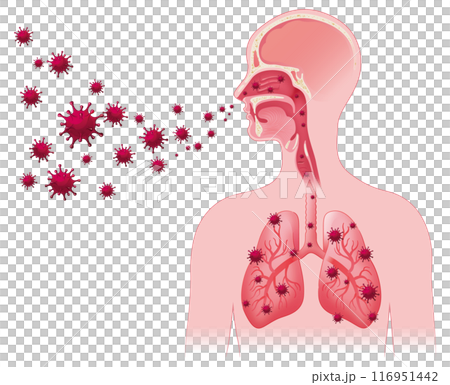 Airborne transmission of the virus Airborne transmission of the virus 116951442