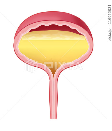 尿が溜まった膀胱 116953021