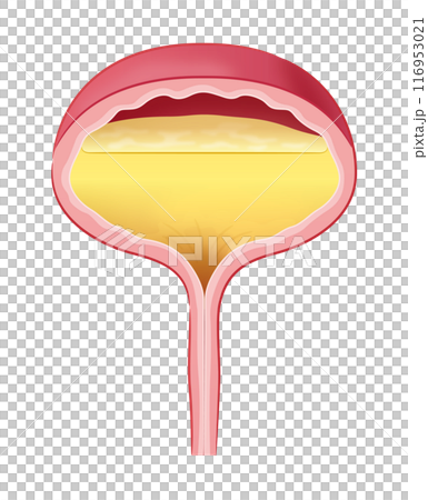 尿が溜まった膀胱 116953021