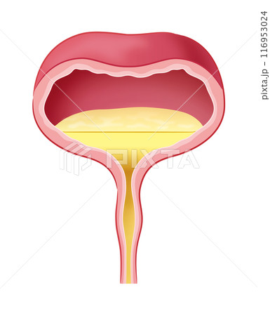 排尿中の膀胱 116953024