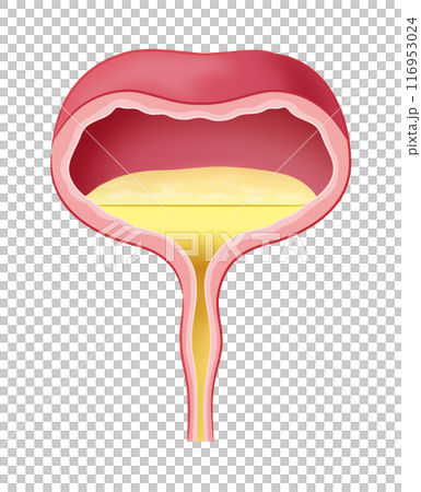 排尿中の膀胱 116953024