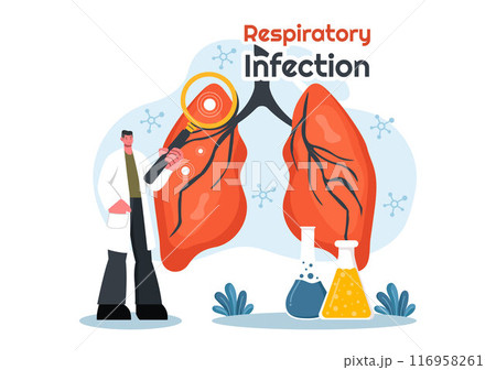 Vector Illustration of Respiratory Infection and Inflammation in the Lungs Caused by Virus Cells on a Background in Healthcare and Medical Concept Vector Illustration of Respiratory Infection and Inflammation in the Lungs Caused by Virus Cells on a Background in Healthcare and Medical Concept 116958261