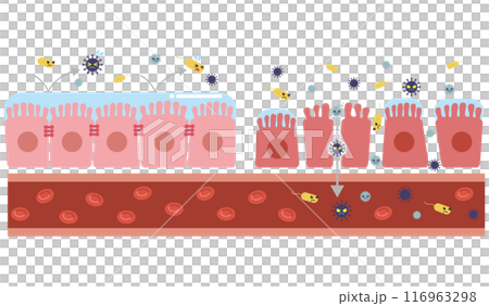 Illustration of leaky gut syndrome (without text) 116963298