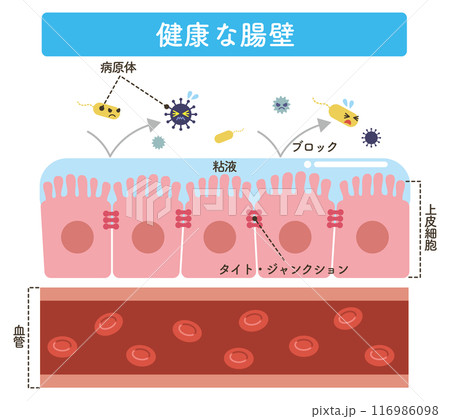 健康な腸壁（文字あり） 116986098