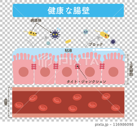 健康な腸壁（文字あり） 116986098