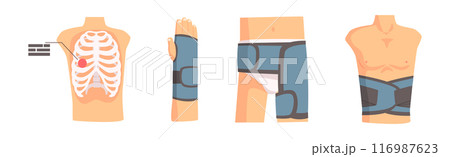 Human Bone and Joint Fracture and Rehabilitation Object Vector Set 116987623