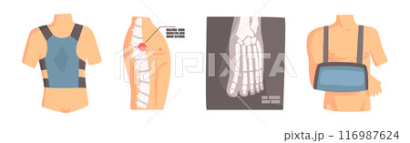Human Bone and Joint Fracture and Rehabilitation Object Vector Set 116987624