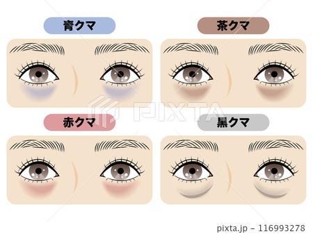 目の下のクマの種類 116993278