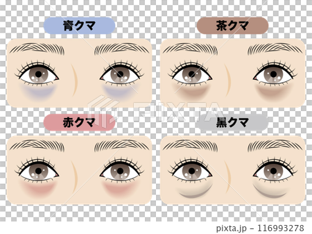 目の下のクマの種類 116993278