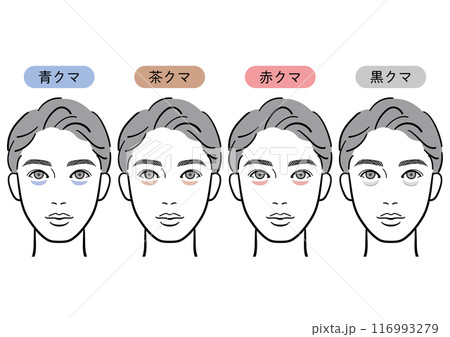 目の下のクマの種類（男性） 116993279