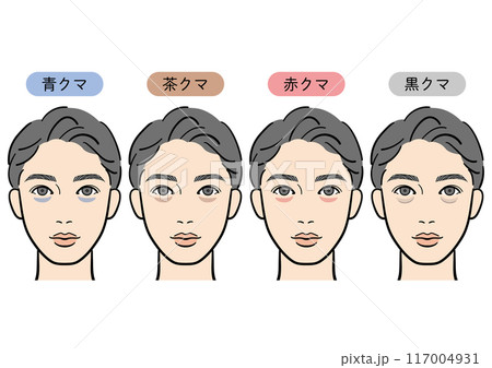 目の下のクマの種類(男性) 目の下のクマの種類(男性) 117004931