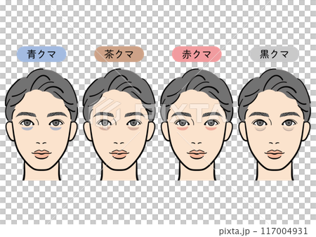黑眼圈的類型（男性） 117004931