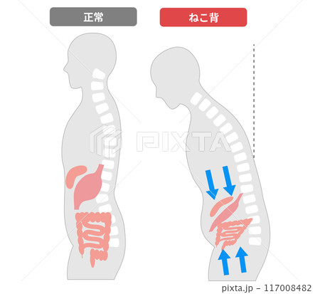 ねこ背により姿勢が悪くなり内臓が圧迫される人の比較図 ねこ背により姿勢が悪くなり内臓が圧迫される人の比較図 117008482
