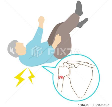 骨粗鬆症による高齢者の転倒骨折の好発部位。肩の骨折 骨粗鬆症による高齢者の転倒骨折の好発部位。肩の骨折 117008502