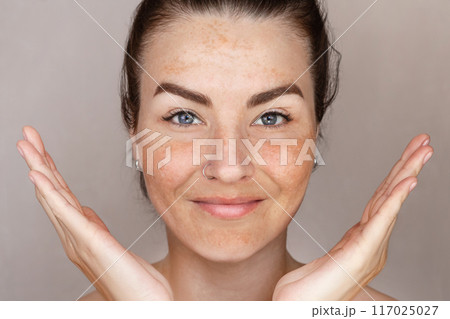 Caucasian woman's face with freckles or age spots, she is smiling and loves her skin close up 117025027
