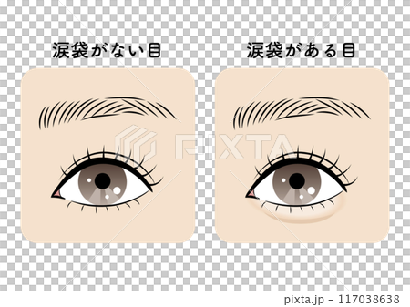 Eyes with and without tear bags Eyes with and without tear bags 117038638
