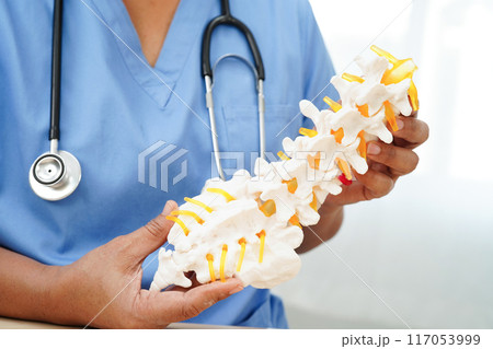 Asian doctor holding spinal nerve and bone model, Lumbar spine displaced herniated disc fragment for treatment medical in the orthopedic department. 117053999