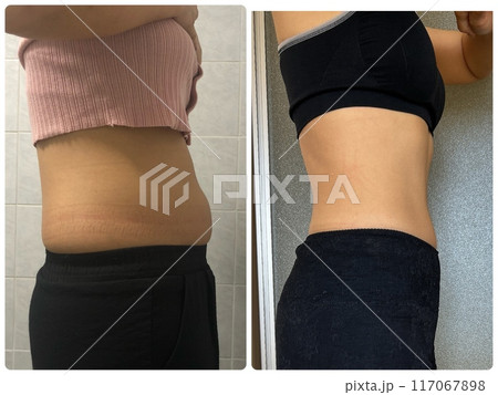 ダイエット 117067898