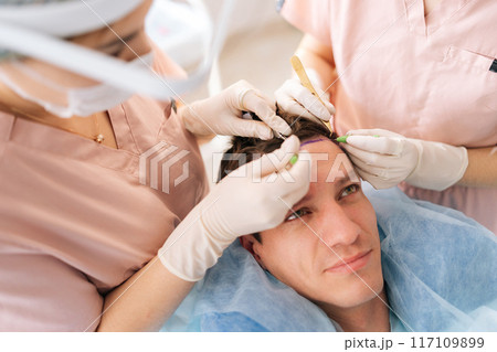 High-angle view of trichologist surgeons carry out hair transplant surgery in operating room to male patient with hairloss problem. Surgical technique that moves hair follicles from part of head. High-angle view of trichologist surgeons carry out hair transplant surgery in operating room to male patient with hairloss problem. Surgical technique that moves hair follicles from part of head. 117109899