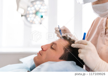 Closeup side view of unrecognizable female nurse drawing using pencil new hairline on head of patient male before hair transplantation surgery in clinic. Concept of professional baldness treatment. Closeup side view of unrecognizable female nurse drawing using pencil new hairline on head of patient male before hair transplantation surgery in clinic. Concept of professional baldness treatment. 117109926