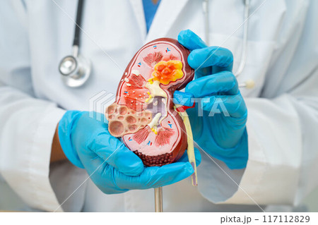 Kidney disease, Chronic kidney disease ckd, Doctor hold human model to treat and study in hospital. Kidney disease, Chronic kidney disease ckd, Doctor hold human model to treat and study in hospital. 117112829