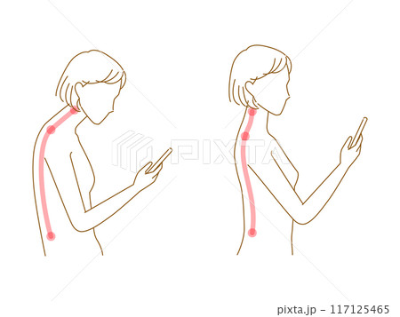 ストレートネック(スマホ首)と良い姿勢の女性イラストセット ストレートネック(スマホ首)と良い姿勢の女性イラストセット 117125465
