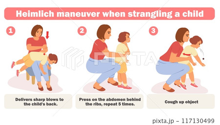 Child help with choking infographic poster vector illustration 117130499