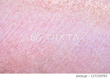 dry and dehydrated human skin texture background dry and dehydrated human skin texture background 117159765