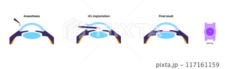 EVO ICL poster 117161159