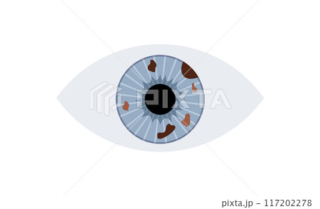 Iris melanoma anatomy Iris melanoma anatomy 117202278