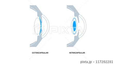 EVO ICL poster 117202281