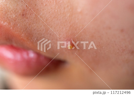 15 years old 117212496