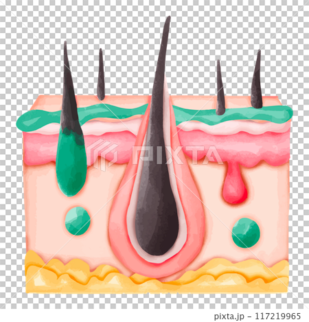 Watercolor Illustration of Hair Follicle with Sebum and Pus Watercolor Illustration of Hair Follicle with Sebum and Pus 117219965